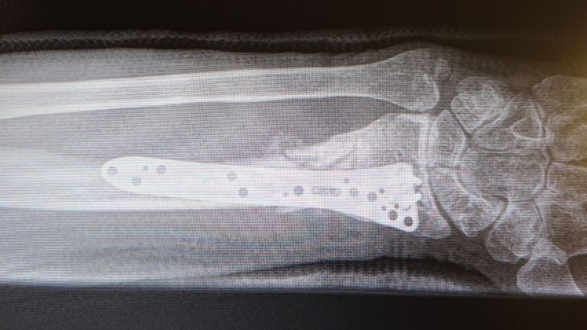 resized wrist.jpg